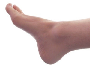 Swelling: Is it serious? Symptoms, causes, and treatment