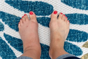 When to See a Doctor for Swollen Feet - Blog
