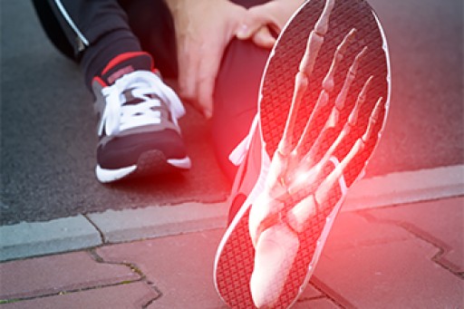 Dealing with Stress Fractures of the Foot and Ankle